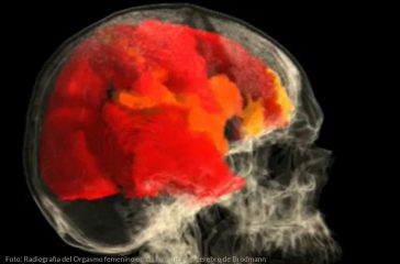 imagen de resonancia magnetica del cerebro de una mujer durante un orgasmo